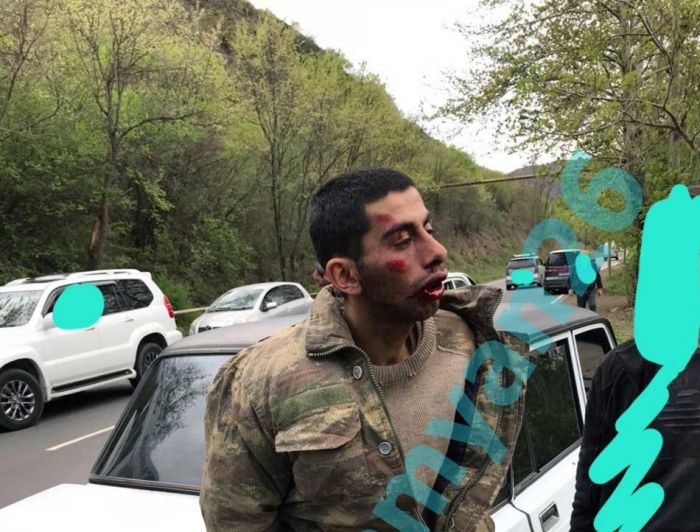 LES ARMÉNIENS "HUMANISTES" PRENNENT EN OTAGE ET MALTRAITENT DES SOLDATS AZERBAÏDJANAIS